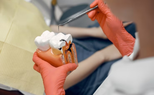 Dental-Restoration
